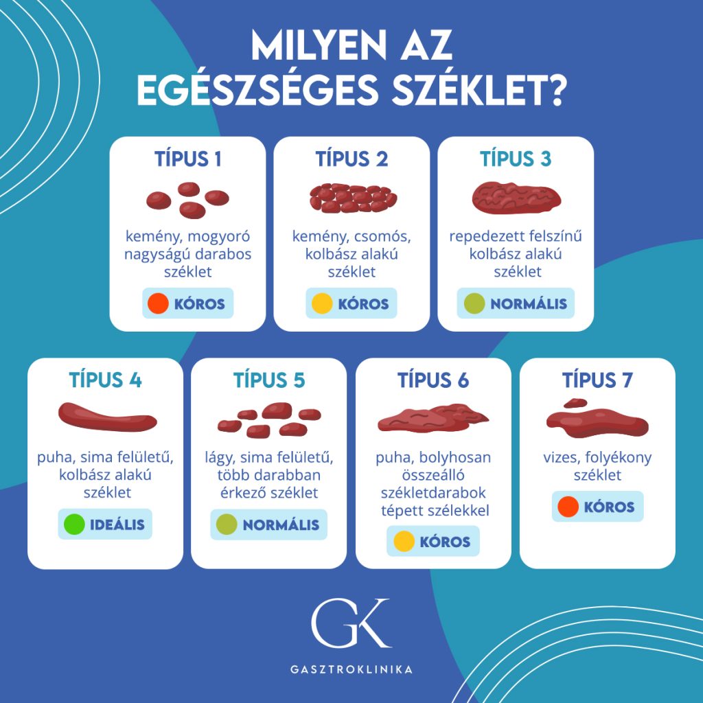 Székrekedés okai